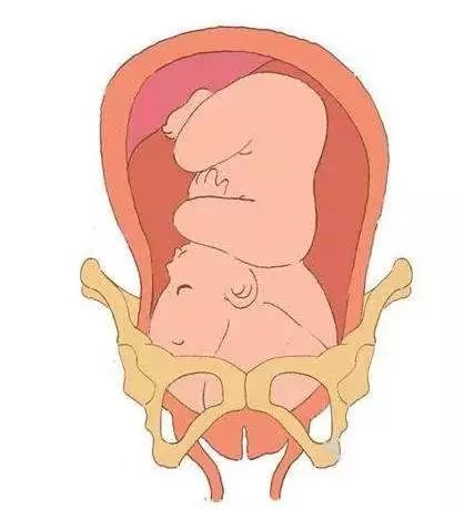 胎儿入盆多久生?怎样判断是否入盆