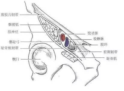 canal,股鞘(femoral sheath,腹横筋膜(transversalis fascia)卵圆窝