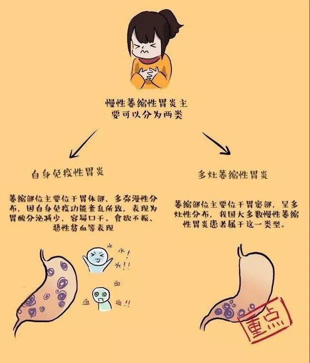 40岁后出现这些症状,当心慢性萎缩性胃炎?