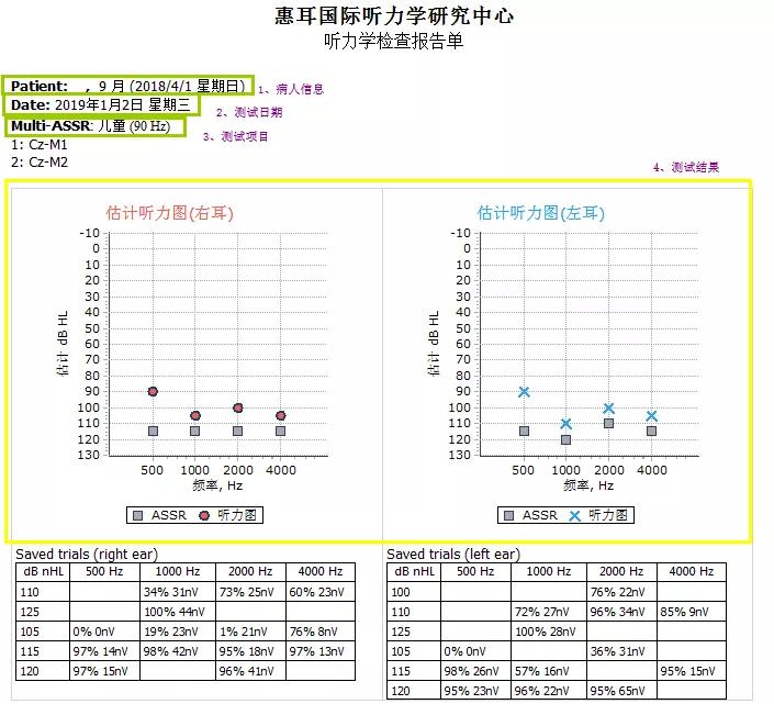 听性稳态反应(assr)是一种具用频率特异性听力评估的客观方法,且强度