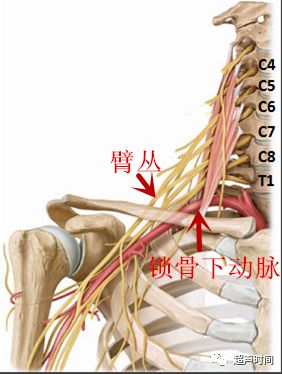 超声典型病例臂丛神经鞘瘤