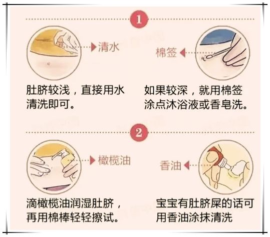新生儿脐部护理步骤图片