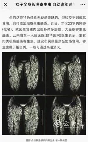龙虾病来了一晚上几十个永康人被送进医院你还敢吃吗