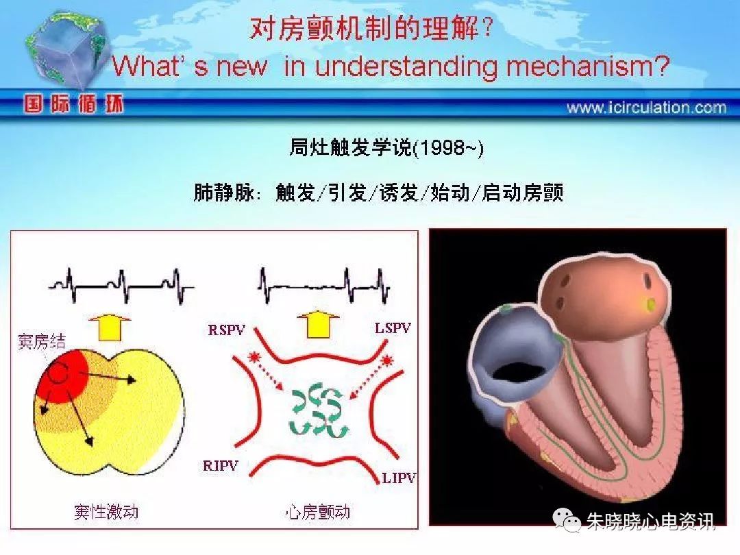 射频消融术介绍