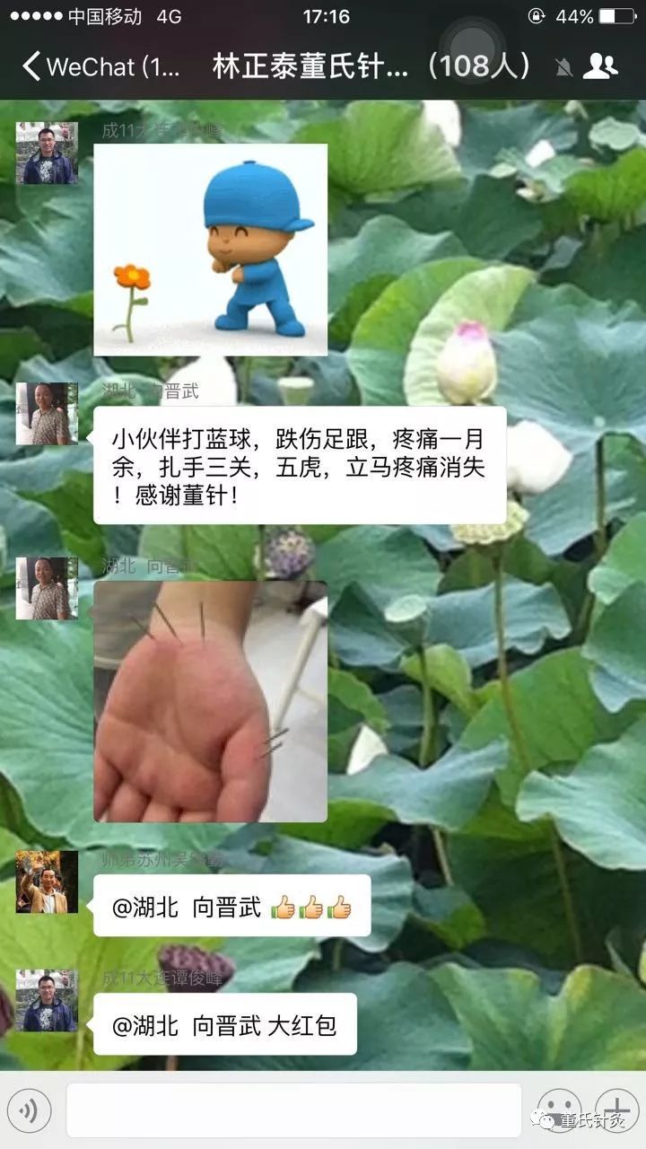 董氏针灸林正泰案例分享之五虎穴