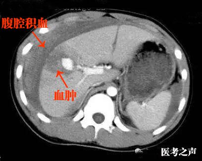 执医技能ct阅片速成让你秒懂