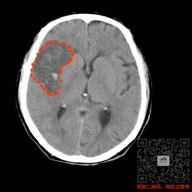 执医技能ct阅片速成让你秒懂