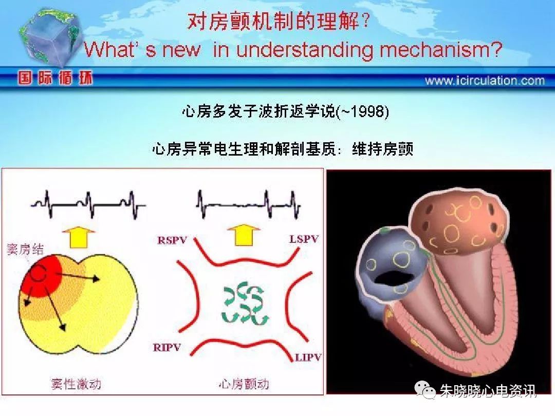 射频消融术介绍