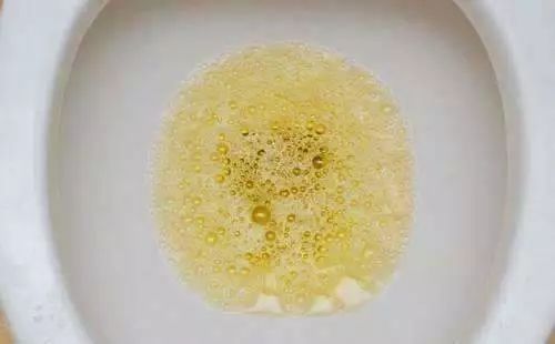 45岁男子尿酸高达830突然肾衰竭提醒这2种东西害人不浅