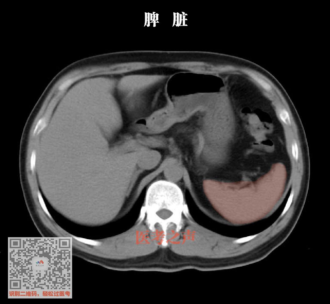脾脏很脆,容易受伤破裂脾脏结构和被膜破坏以后脾脏的形态就会发生