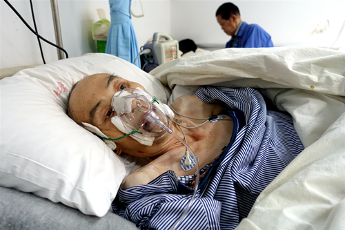 武汉人民医院危重病人张习辉进中风脑卒中死亡线上挣扎