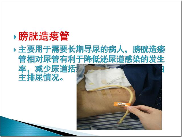 人体常见引流管的管理