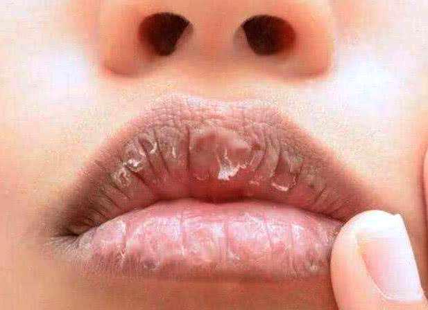 嘴唇没有血色.