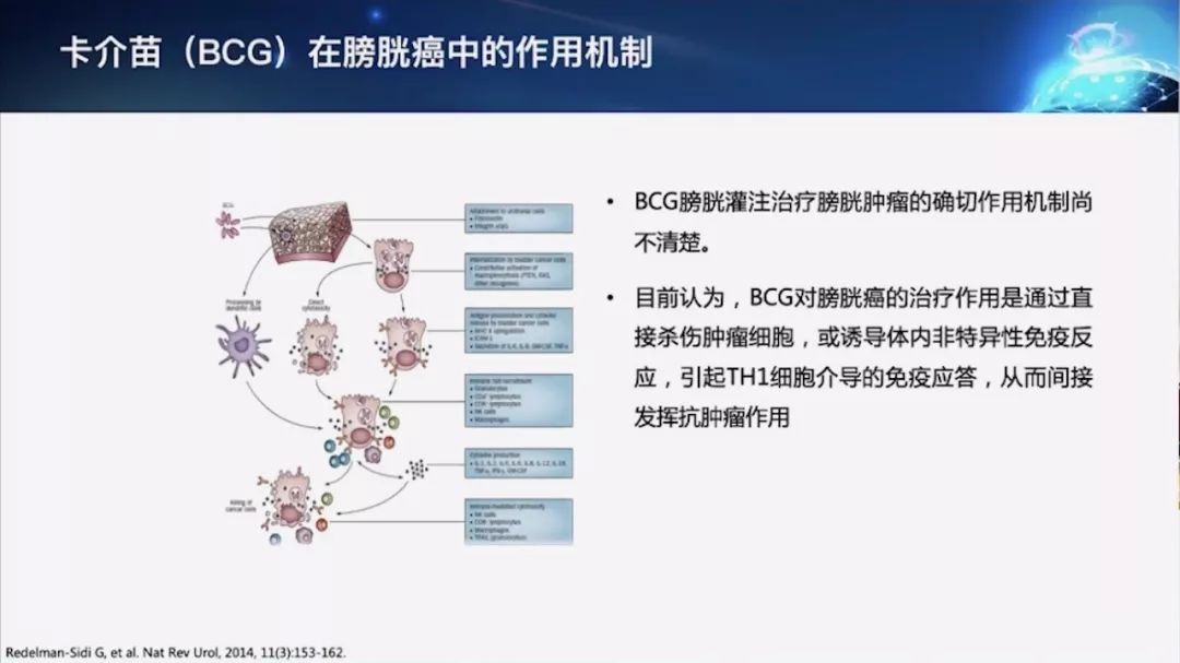 復旦腫瘤葉定偉教授解讀非肌層浸潤性膀胱癌膀胱灌注治療專家共識