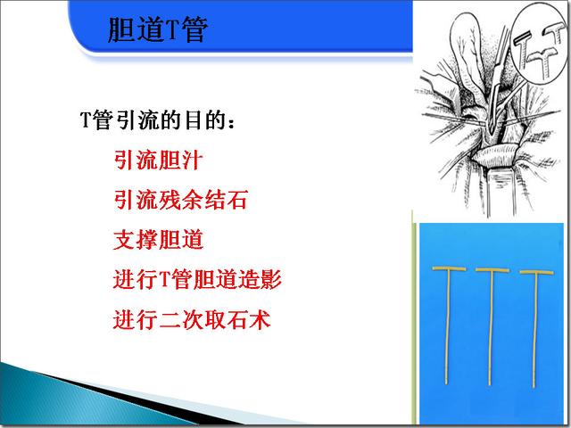 人体常见引流管的管理