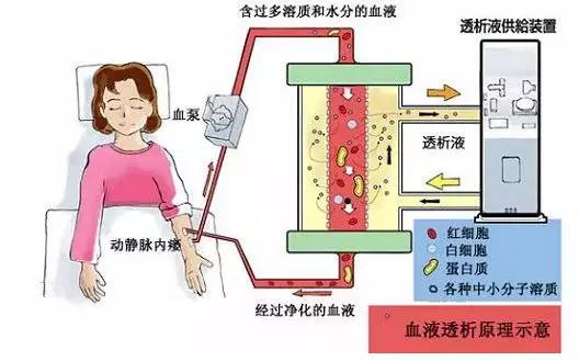 血透机的维护与消毒_柠檬酸