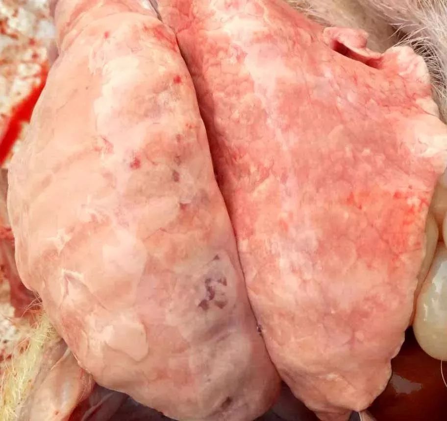 间质性肺炎_肺泡