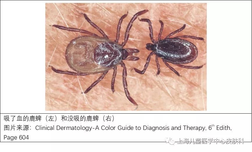 蜱虫的天敌是什么图片