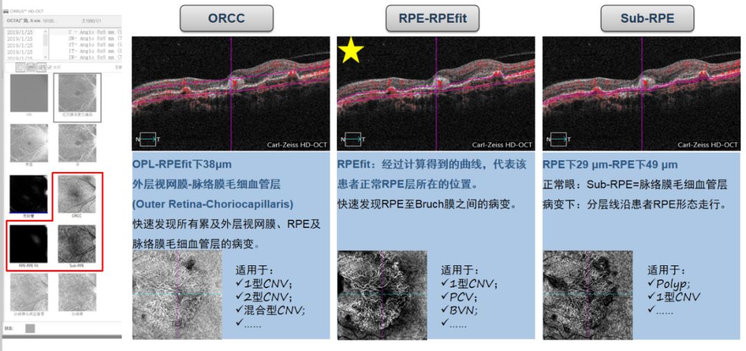 座谈会现场亮点五窥见未来octa的方向angelo rago先生蔡司诊断设备