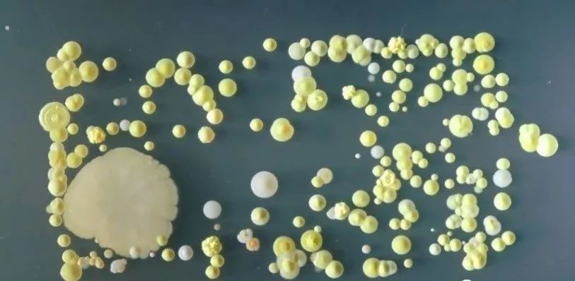 到无害的金葡萄球菌,微球菌,酵母菌,莫拉氏菌和芽孢杆菌,经常是二三十