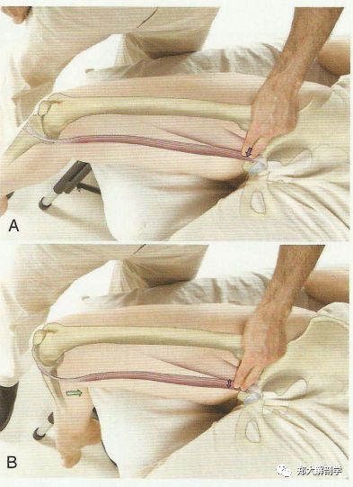 闭孔神经解剖易卡压点触诊牵张治疗