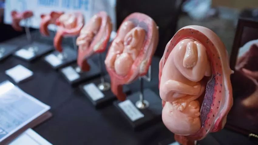 禁止怀孕8周后堕胎,即使是强奸或乱伦也不能例外,实施堕胎手术的医生
