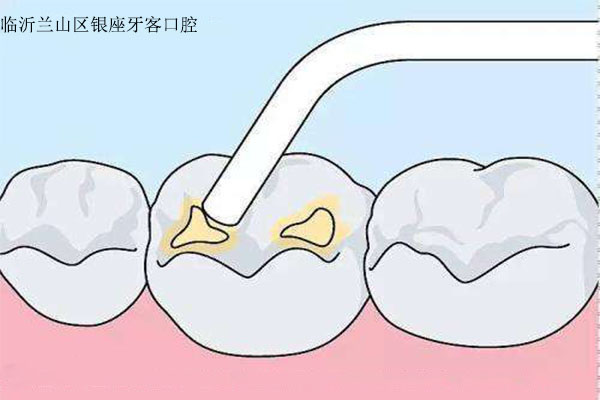 小孩子補牙需要打麻藥嗎如何避免孩子出現口腔問題