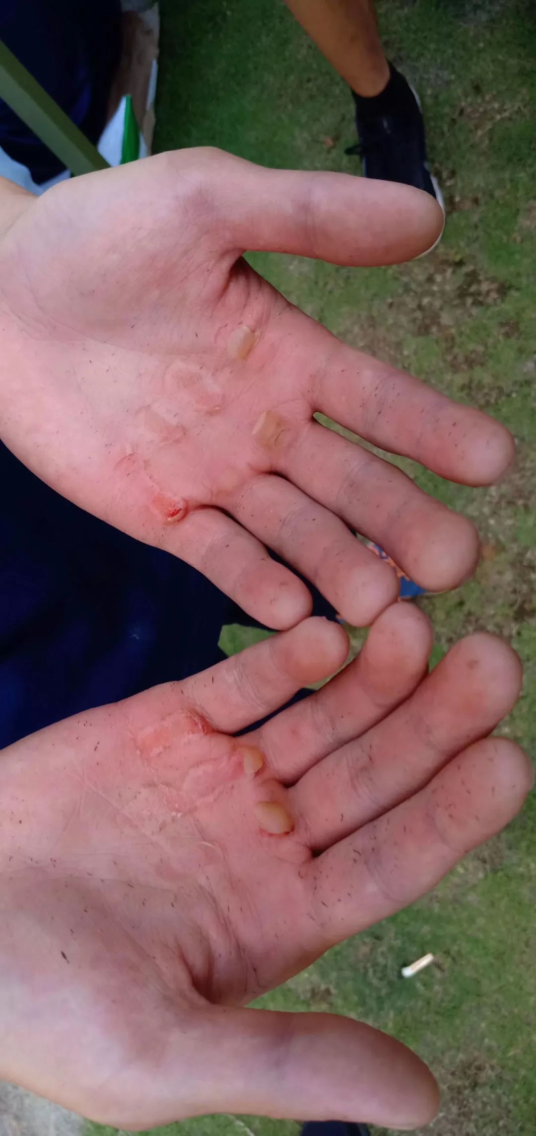 他们训练起来真让人心疼_单杠