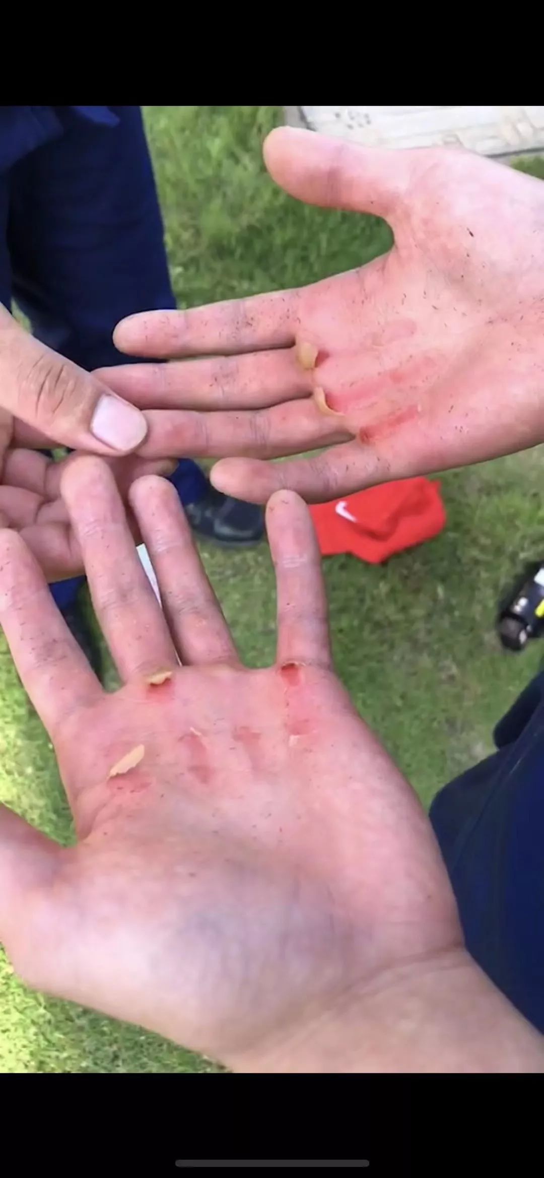 他们训练起来真让人心疼_单杠