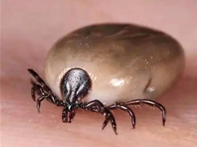 另外,被蜱虫叮咬的人发病前会有1至2周的潜伏期,之后可能会出现高热