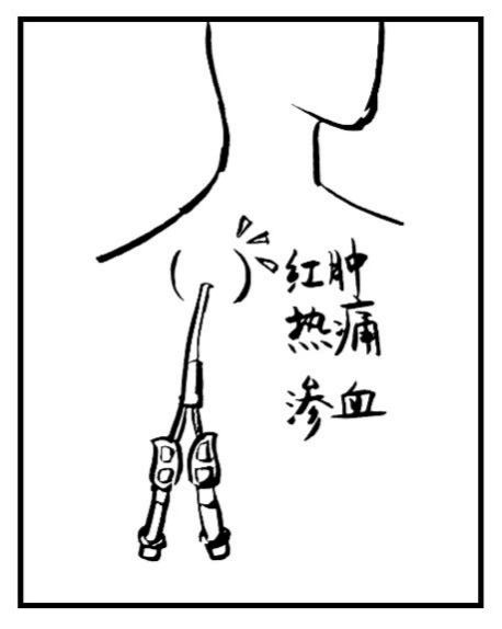 同时也提高您的透析质量,延长您的寿命.