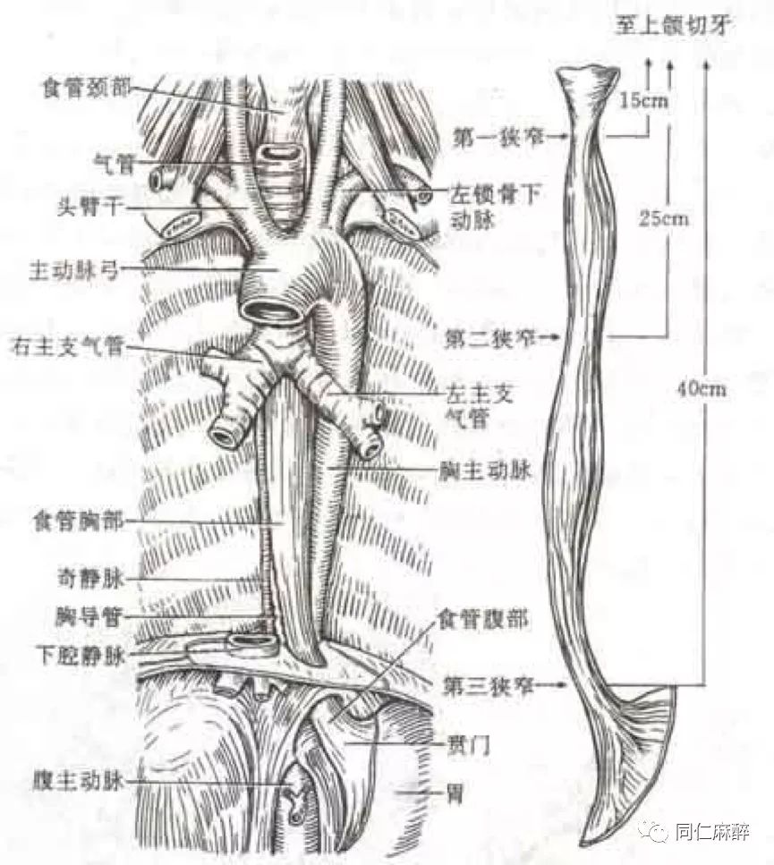 食道手绘图图片