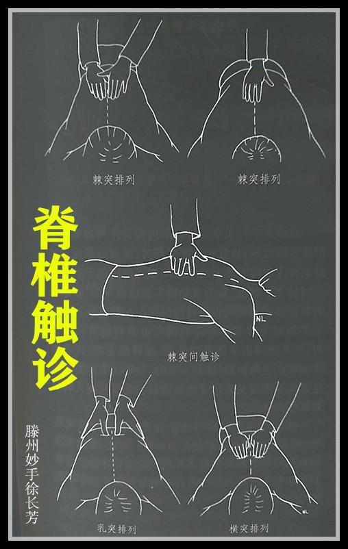 腰椎间盘突出怎么按摩图片