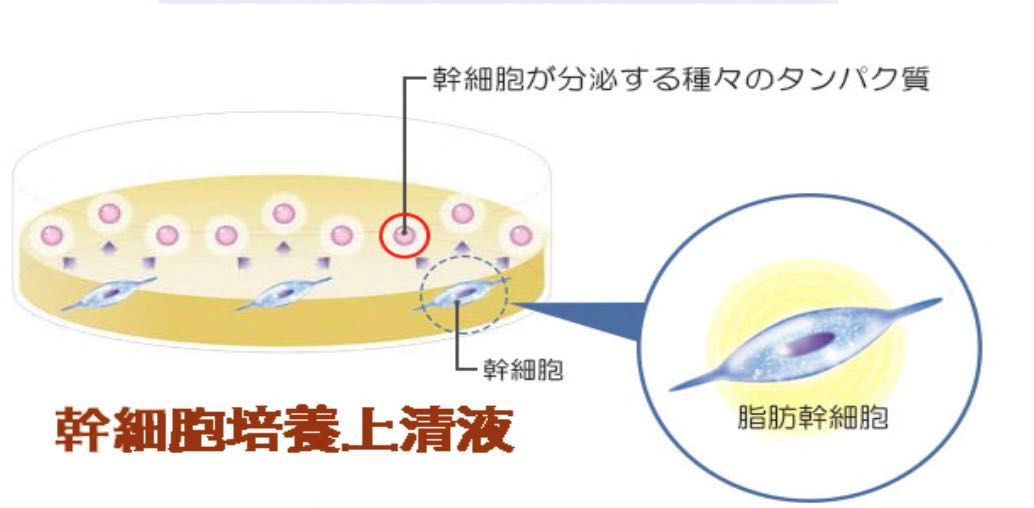 脂肪干细胞上清液疗法,是将脂肪干细胞分泌出来的复数的成长因子以及