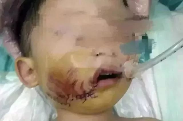 真实的蛋疼男子遭没牵绳大狗疯狂袭击蛋蛋被咬隔着屏幕都觉得痛