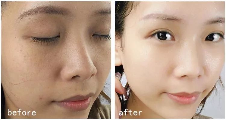 斑点多脸蜡黄20岁看着像40岁一个小方法28天色斑全没了