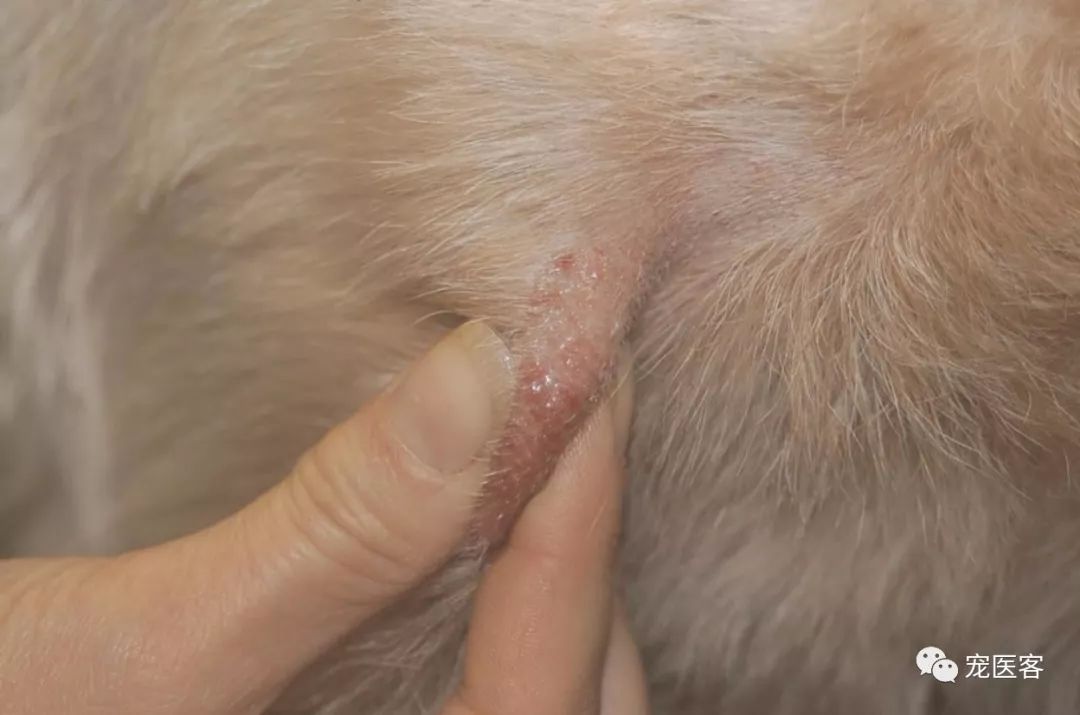 皮肤刮片发现体外寄生虫