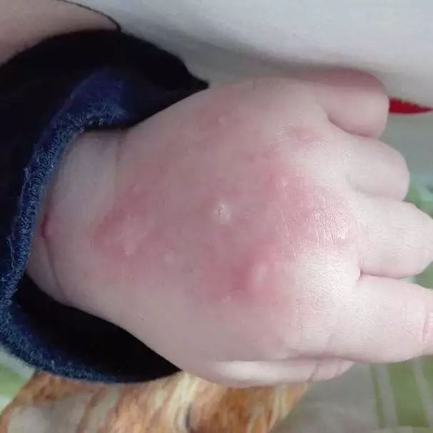 夏日灭蚊大作战,它成为蚊子界的噩梦,安全高效,让宝