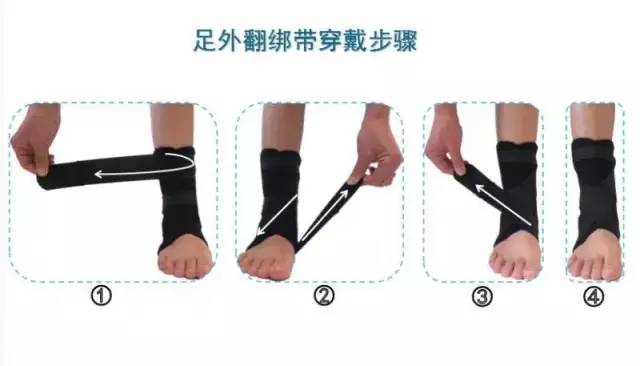 外翻足与内翻足的自我运动治疗:这两种足部位置异常,均可透过适当治疗