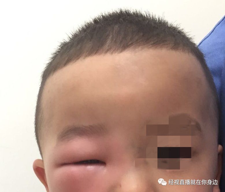 回来后却出现一些"怪毛病"但没想到,不少儿童随父母外出旅行,端午小