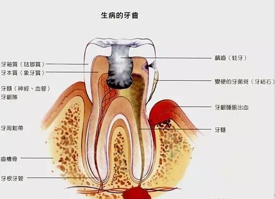 成牙本质细胞突起图片图片