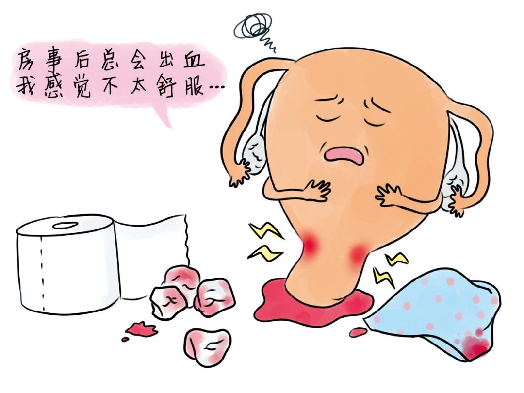 同房后出血警惕疾病找上门
