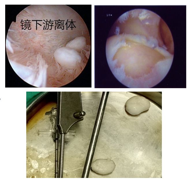 保山市二院疼痛科关节镜