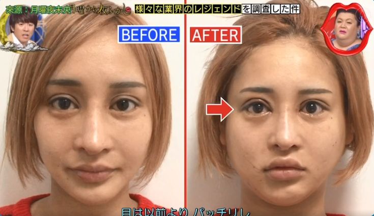 从石原里美到广濑丝丝这位日本整容明星到底想把自己变成谁