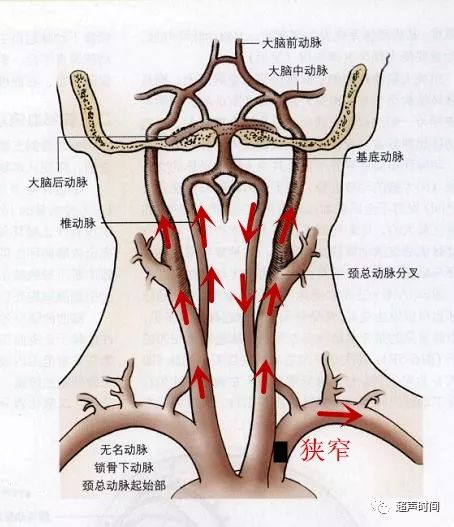 无名动脉解剖图图片