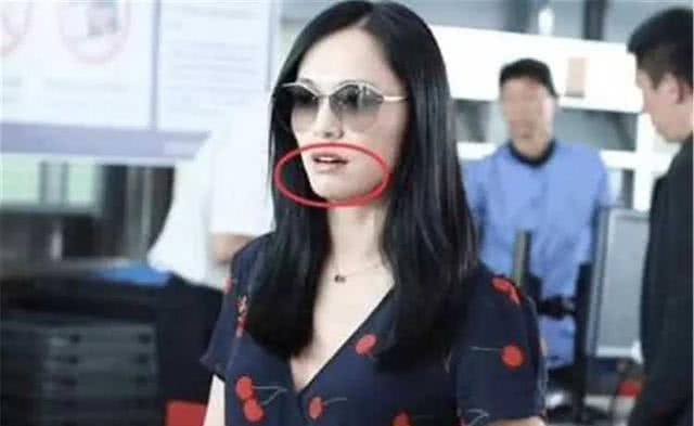 有媒体在机场拍到了姚晨的近照,发现她的标志性大嘴不见了,嘴巴变小了