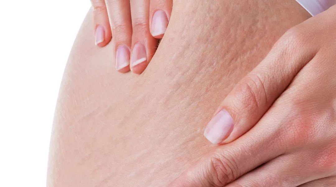 护肤品再贵,不注意皮肤的这两大杀手都白搭!_脂肪