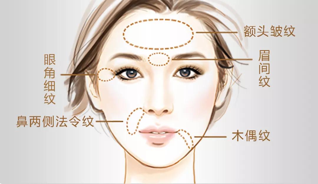 广州微整形：都市美容新潮流