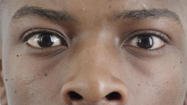 动物的眼睛为什么没有眼白?