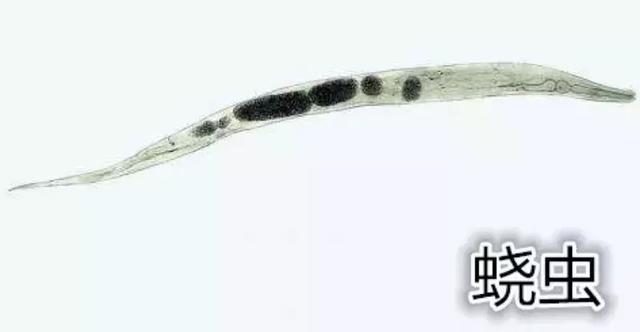 宝宝屁屁痒,妈妈脱下裤子:许多小虫子,还在动_蛲虫